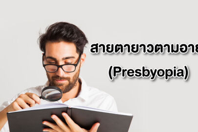 สายตายาวตามอายุ (Presbyopia)