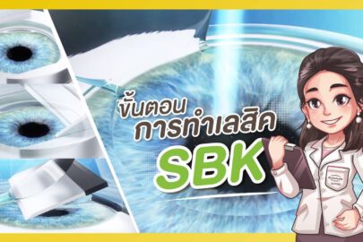 ขั้นตอนการทำ SBK