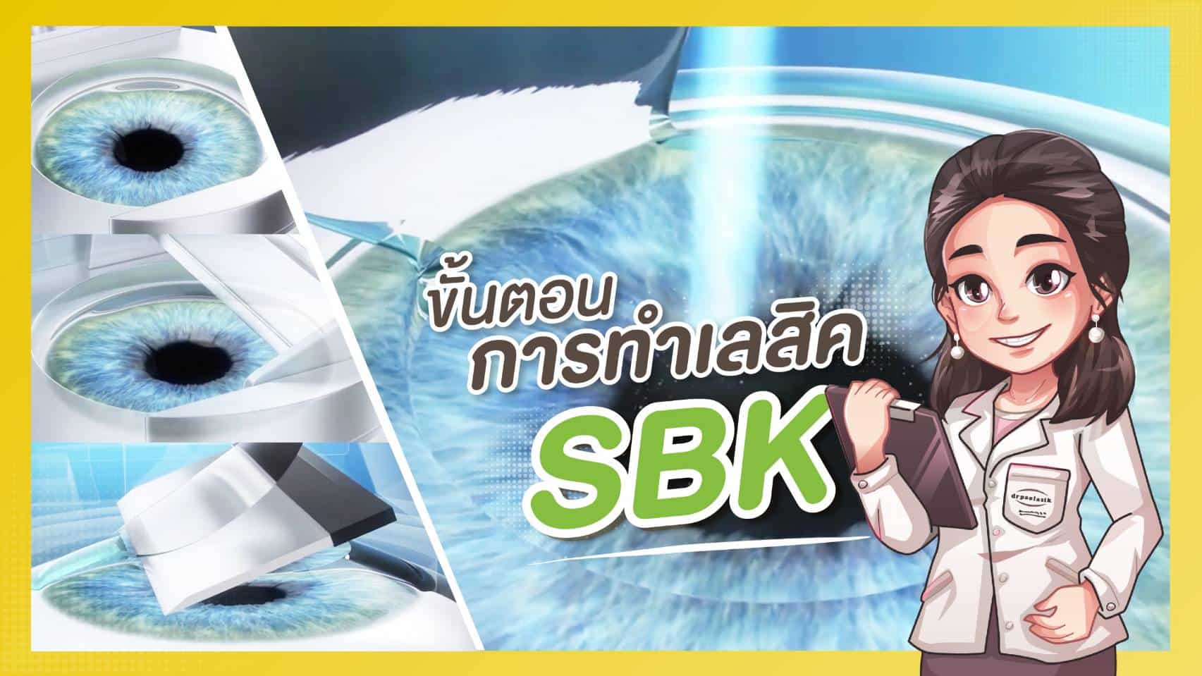 ขั้นตอนการทำ SBK